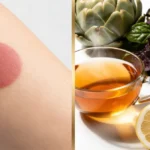 Berberine patches vs real food comparison: transdermal berberine patch on arm skin on left versus artichoke heart, steaming golden herbal tea, halved lemon and berberine powder jar on right, separated by gold dividing line